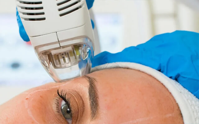 Tixel C® Skin Rejuvenation